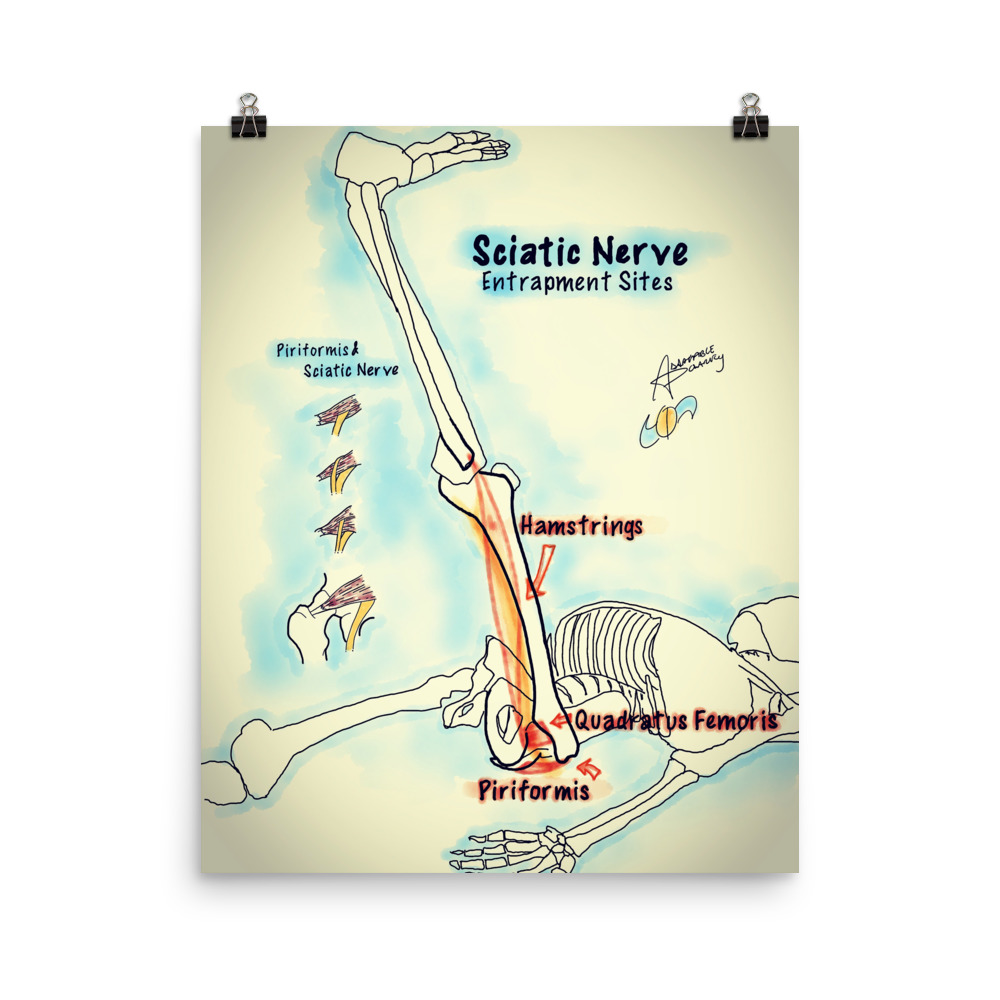 icd 10 code for sciatic nerve compression