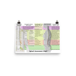 Spinal Assessment Chart (medium and large poster)